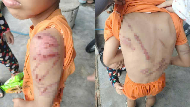 L&yacute; do người cha đ&aacute;nh con 10 tuổi g&acirc;y bức x&uacute;c trong x&atilde; hội hiện nay - Ảnh 1.