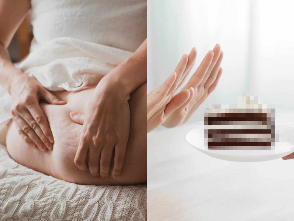 1 loại thức ăn sẽ l&agrave;m cho t&igrave;nh trạng da sần vỏ cam tồi tệ hơn! B&aacute;c sĩ da liễu chỉ c&aacute;ch cải thiện da cam ngay tại nh&agrave; kh&ocirc;ng cần thẩm mỹ- Ảnh 1.