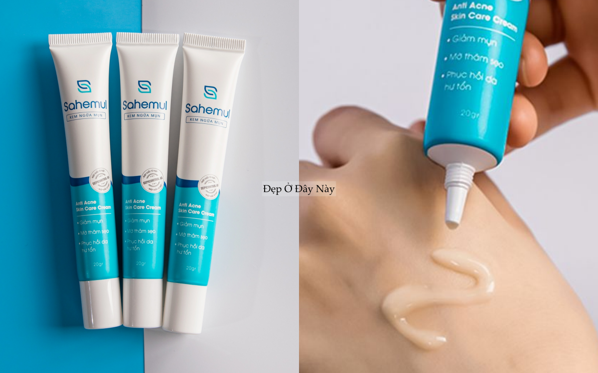 5 lọ kem chấm mụn 