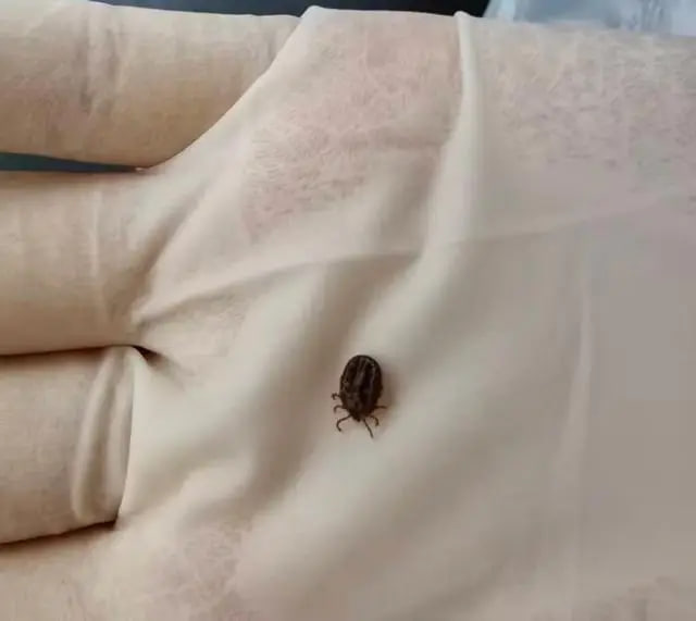 Bé 1 tuổi bị ve chui vào da đầu, bác sĩ cảnh báo: Tuyệt đối không tự ý giật ra - Ảnh 2.