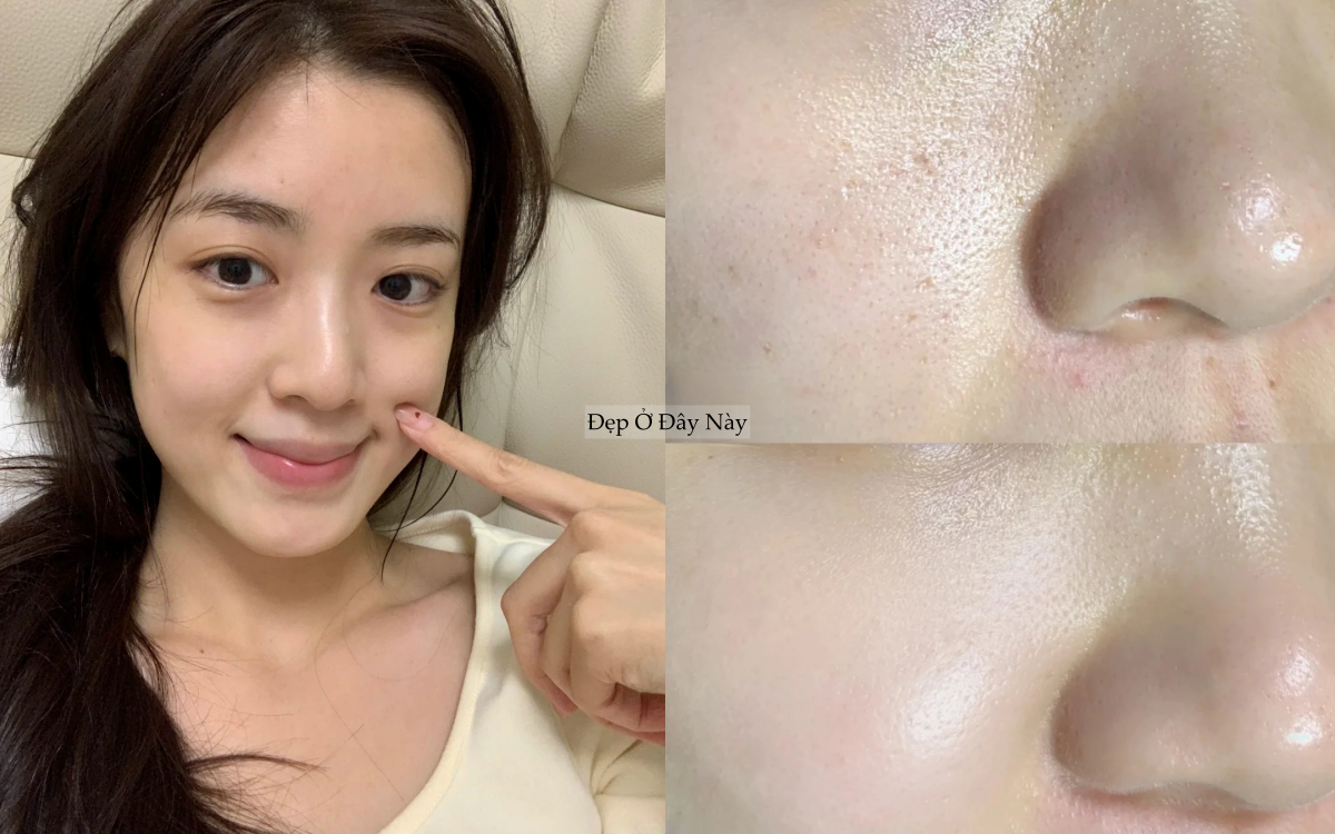 5 serum ngừa l&atilde;o h&oacute;a 