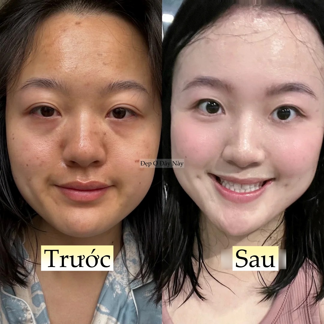 L&agrave;m 5 việc n&agrave;y khi đi ngủ, l&agrave;n da của n&agrave;ng blogger như 