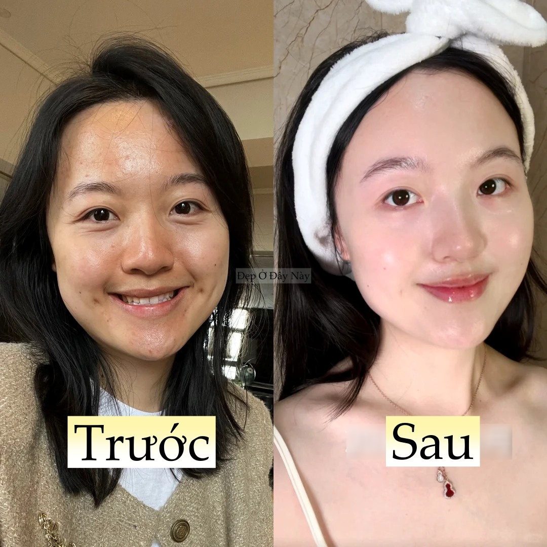 L&agrave;m 5 việc n&agrave;y khi đi ngủ, l&agrave;n da của n&agrave;ng blogger như 