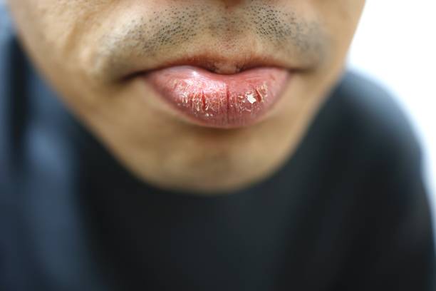 4 sai lầm khiến đàn ông kém sắc và nặng mùi trong mùa hè: Không cần thơm nức, không thúi là được - Ảnh 5.