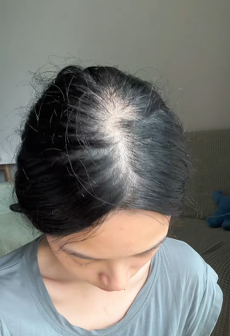 T&ocirc;i ki&ecirc;n tr&igrave; chăm t&oacute;c hơn 1 năm v&agrave; nhận ra: Kh&ocirc;ng phải sản phẩm đắt tiền, m&agrave; 3 điều n&agrave;y mới quyết định t&oacute;c đẹp hay kh&ocirc;ng - Ảnh 1.