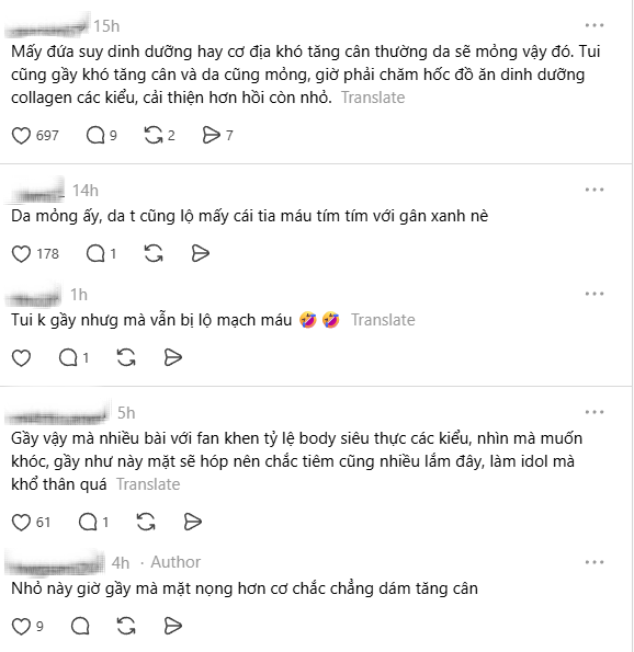 Đ&ocirc;i ch&acirc;n triệu đ&ocirc; của Jang Wonyoung lộ thứ bất thường- Ảnh 3.