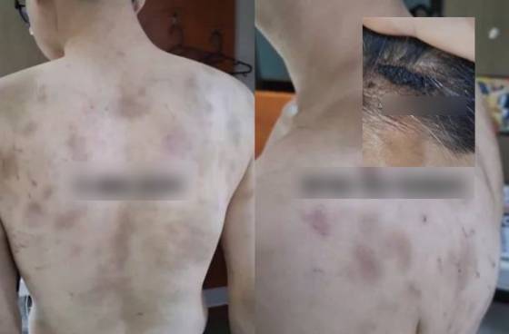 R&uacute;ng động H&agrave;n Quốc: Nam nh&acirc;n vi&ecirc;n bị chủ qu&aacute;n h&agrave;nh hạ v&agrave; &eacute;p l&agrave;m việc 20 giờ/ng&agrave;y - Ảnh 1.