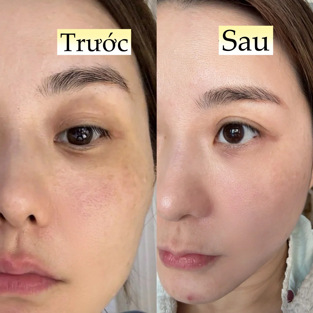 Đi ngủ sớm v&agrave; d&ugrave;ng thứ n&agrave;y l&ecirc;n da mỗi tối, l&agrave;n da của t&ocirc;i sau 1 th&aacute;ng đ&atilde; thay đổi ho&agrave;n to&agrave;n - Ảnh 6.