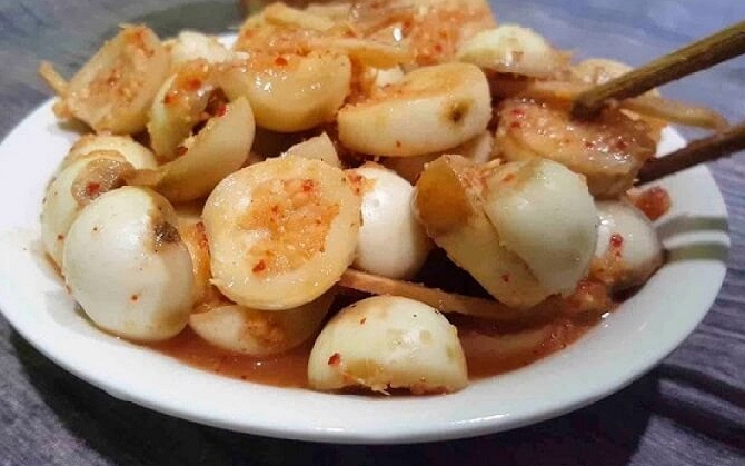 Đột quỵ sau h&uacute;t mỡ l&agrave;m đẹp - Ảnh 2.