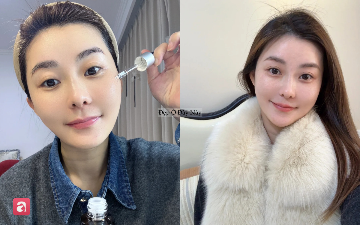 Đi ngủ sớm v&agrave; d&ugrave;ng thứ n&agrave;y l&ecirc;n da mỗi tối, l&agrave;n da của t&ocirc;i sau 1 th&aacute;ng đ&atilde; thay đổi ho&agrave;n to&agrave;n - Ảnh 5.