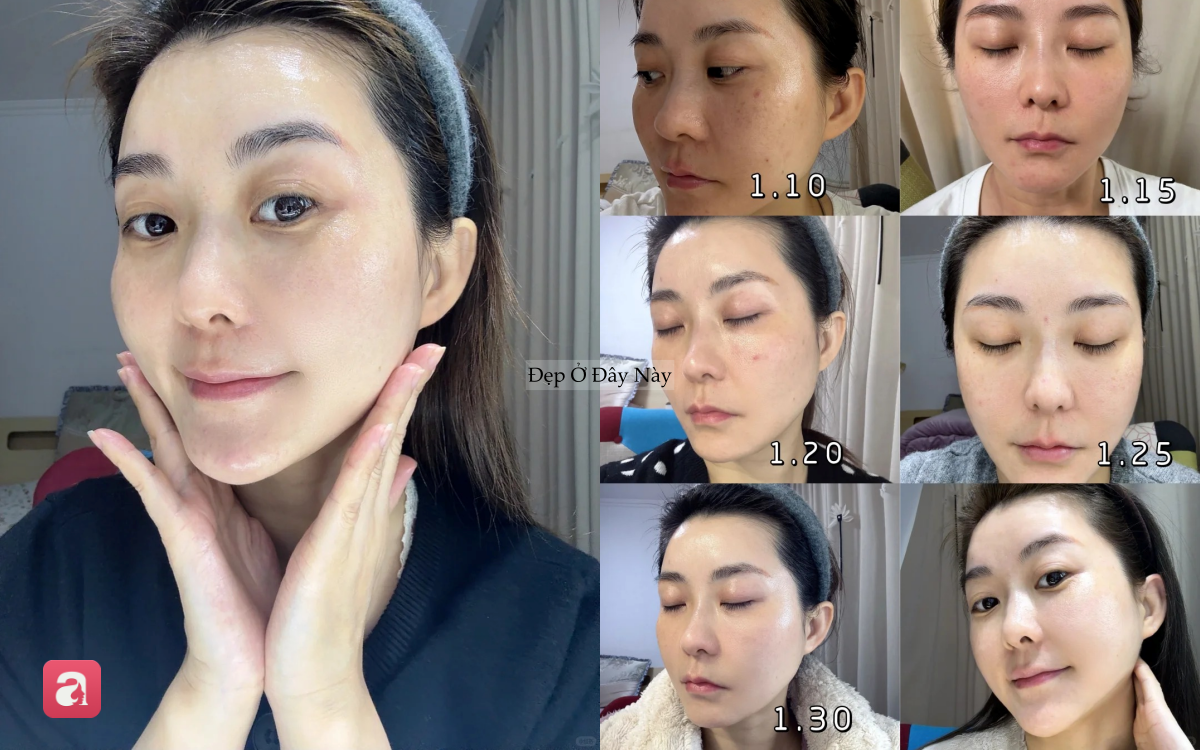 Đi ngủ sớm v&agrave; d&ugrave;ng thứ n&agrave;y l&ecirc;n da mỗi tối, l&agrave;n da của t&ocirc;i sau 1 th&aacute;ng đ&atilde; thay đổi ho&agrave;n to&agrave;n - Ảnh 1.