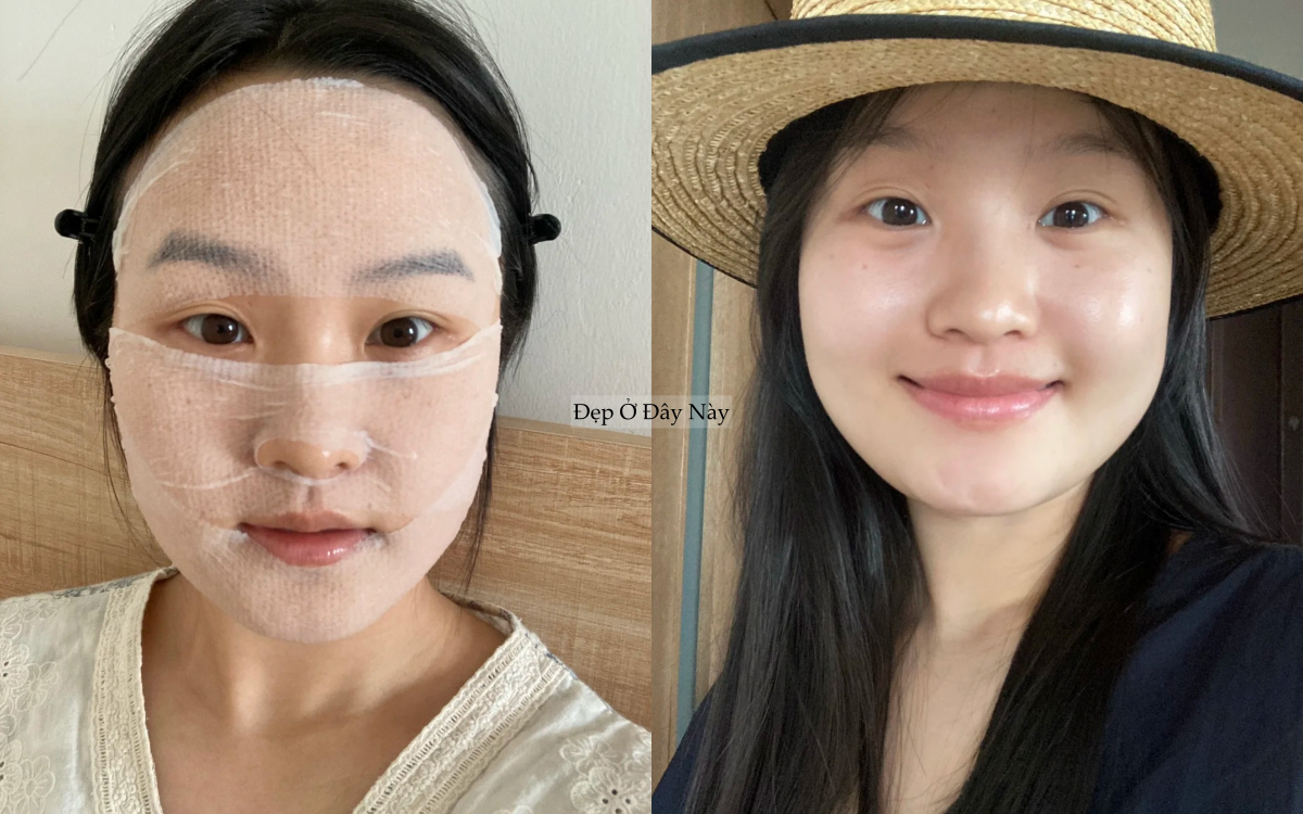 Tạm biệt da dầu b&oacute;ng nhẫy, n&agrave;ng blogger đ&atilde; t&igrave;m ra c&aacute;ch khiến da r&aacute;o mịn v&agrave; ngừa l&atilde;o h&oacute;a - Ảnh 1.