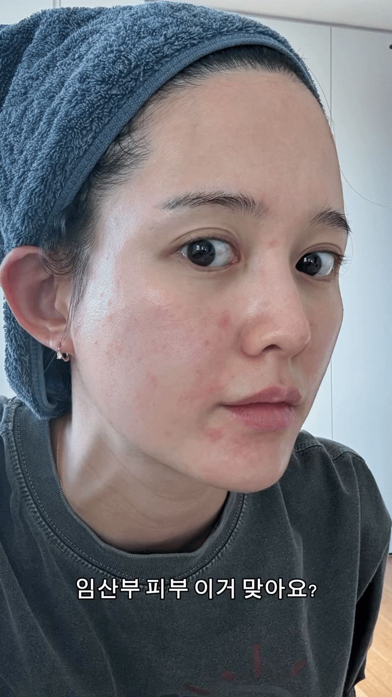 Nam Bo Ra tiết lộ nguy cơ ung thư trước ng&agrave;y cưới v&agrave; h&agrave;nh tr&igrave;nh mang thai - Ảnh 3.