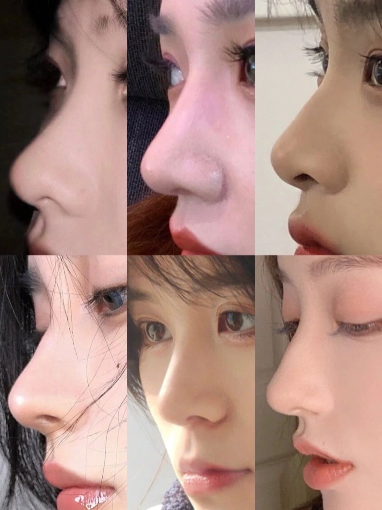 Mũi gồ bay: Xu hướng thẩm mỹ mới cho ph&aacute;i đẹp v&agrave; ph&aacute;i mạnh năm 2026 - Ảnh 5.