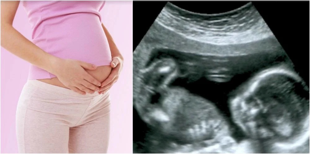 Xử phạt nghi&ecirc;m khắc h&agrave;nh vi b&oacute;i to&aacute;n giới t&iacute;nh thai nhi từ 15 . 5 . 2026 - Ảnh 1.