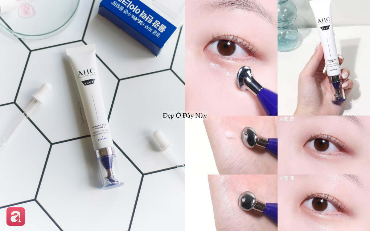 5 kem mắt ki&ecirc;m thanh massage 