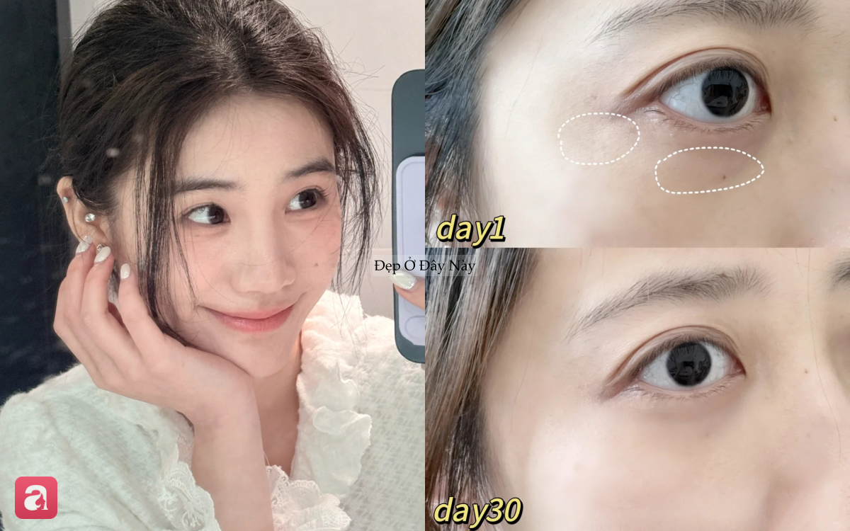 5 kem mắt ki&ecirc;m thanh massage 