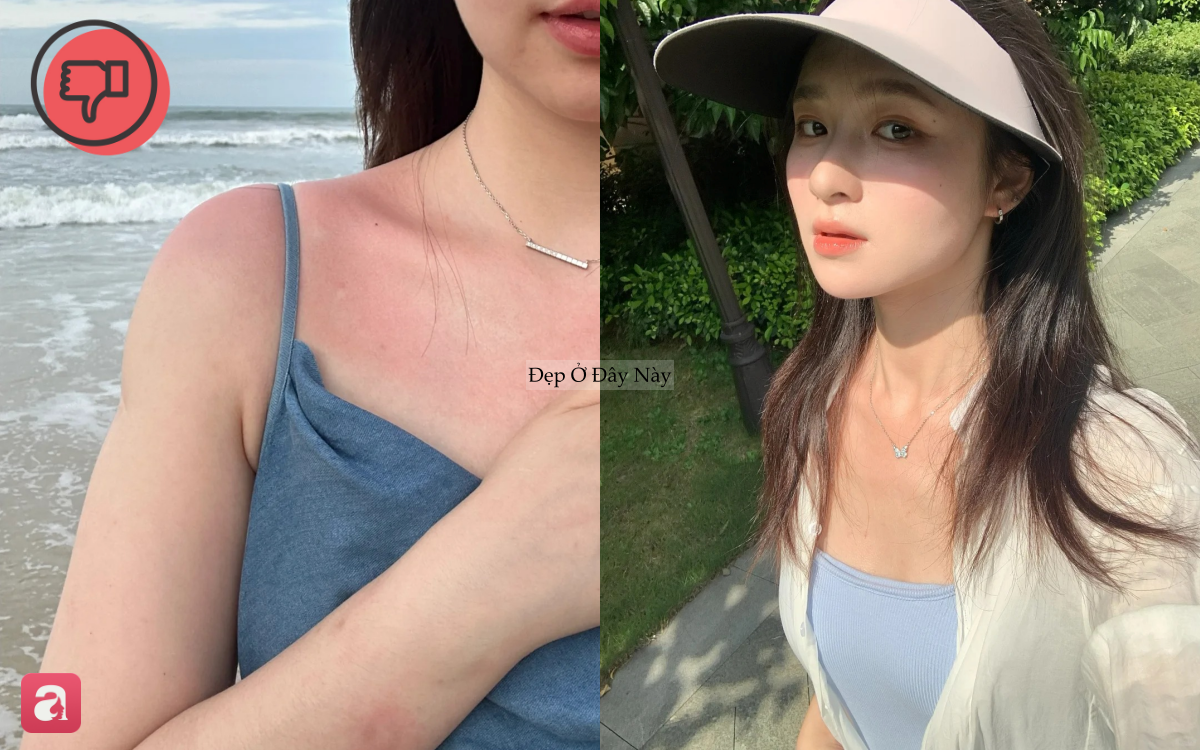 6 lưu &yacute; chống nắng khi đi du lịch để bảo to&agrave;n da khỏi nắng n&oacute;ng - Ảnh 1.