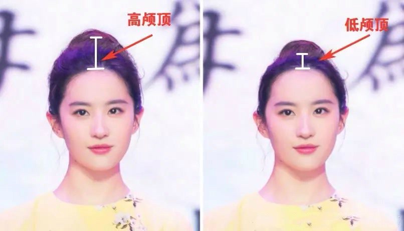 T&igrave;m hiểu xu hướng cao hộp sọ ở Trung Quốc v&agrave; những nguy hiểm sức khỏe tiềm ẩn - Ảnh 3.