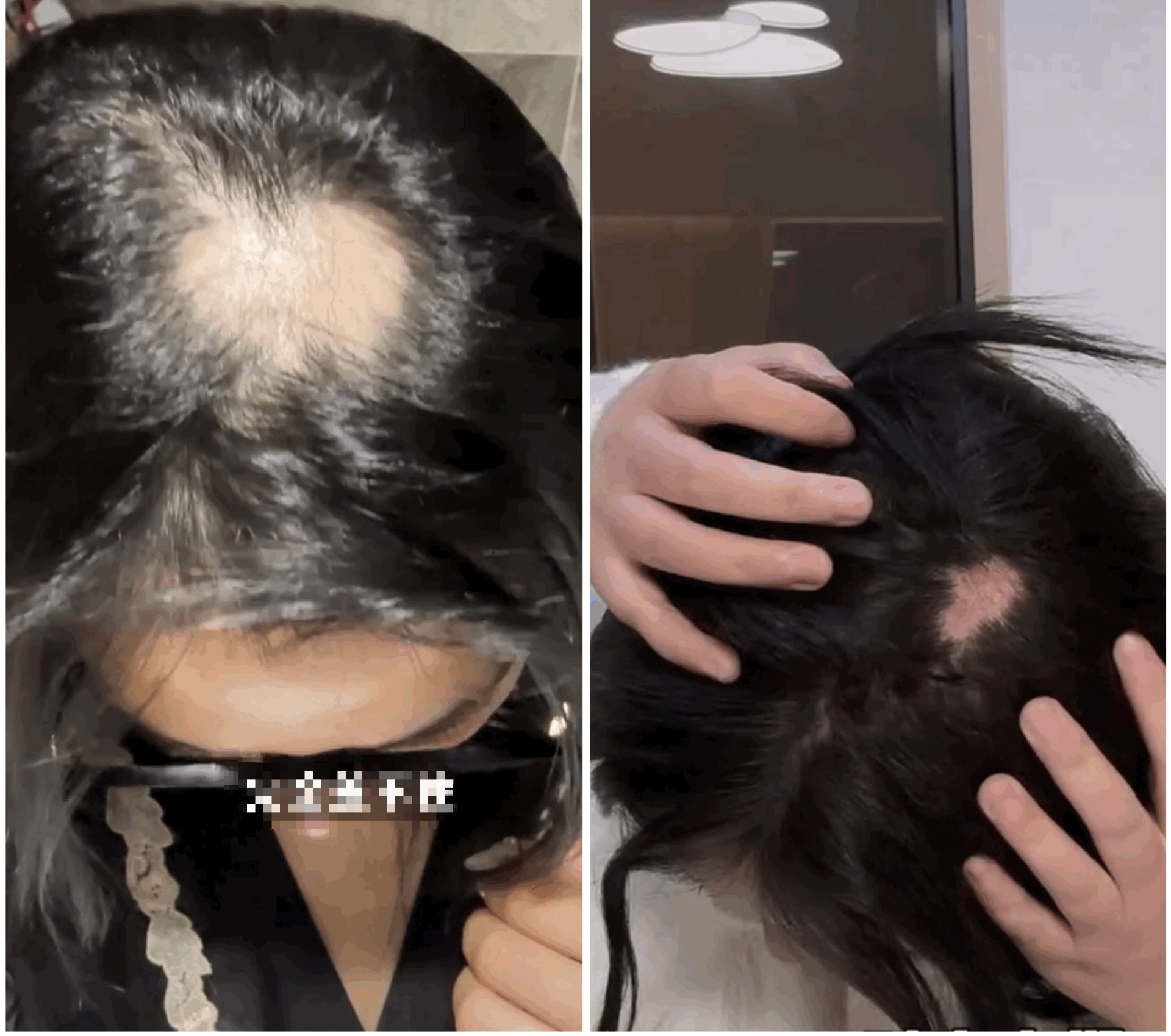 T&igrave;m hiểu xu hướng cao hộp sọ ở Trung Quốc v&agrave; những nguy hiểm sức khỏe tiềm ẩn - Ảnh 9.