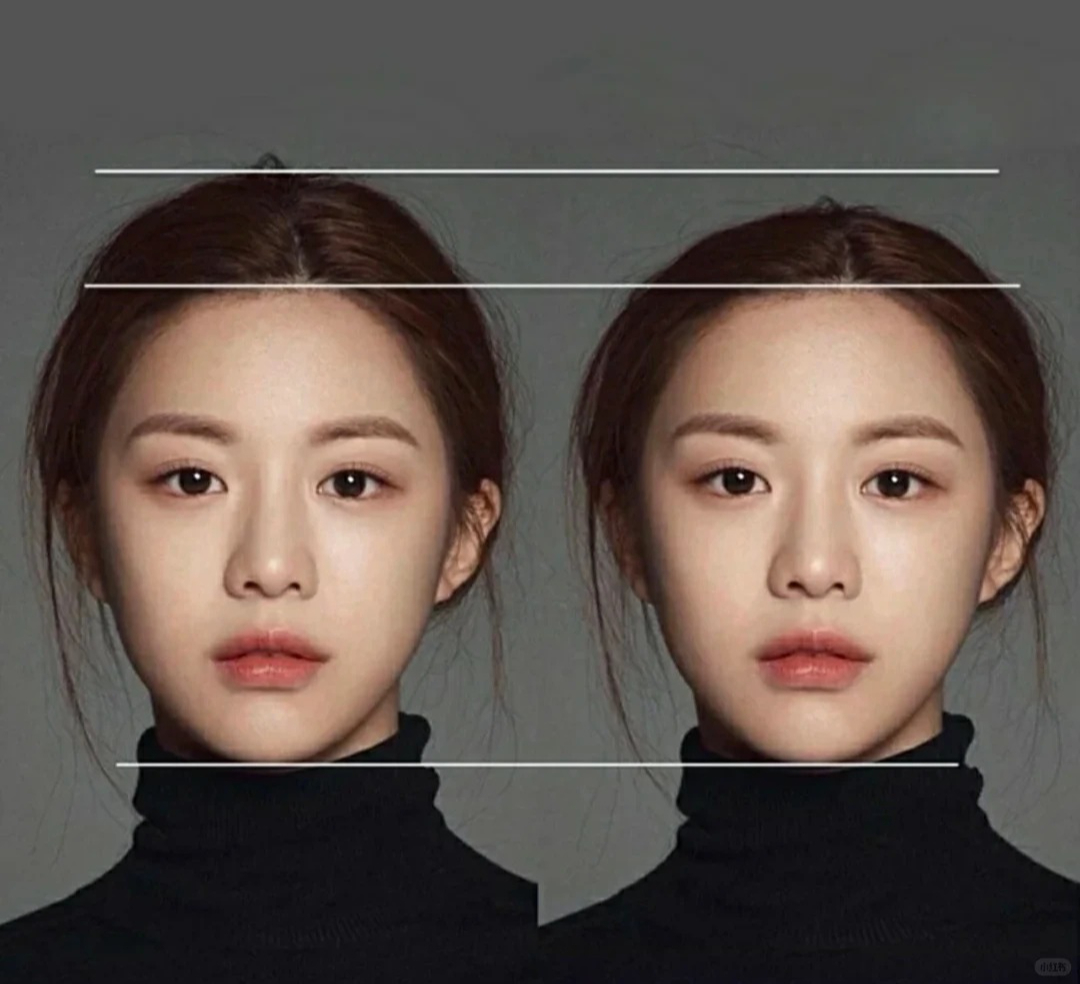 T&igrave;m hiểu xu hướng cao hộp sọ ở Trung Quốc v&agrave; những nguy hiểm sức khỏe tiềm ẩn - Ảnh 4.