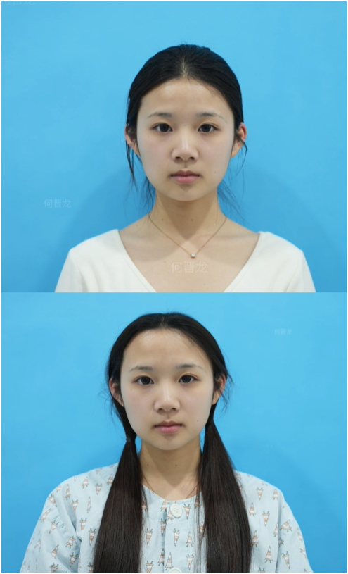 T&igrave;m hiểu xu hướng cao hộp sọ ở Trung Quốc v&agrave; những nguy hiểm sức khỏe tiềm ẩn - Ảnh 2.