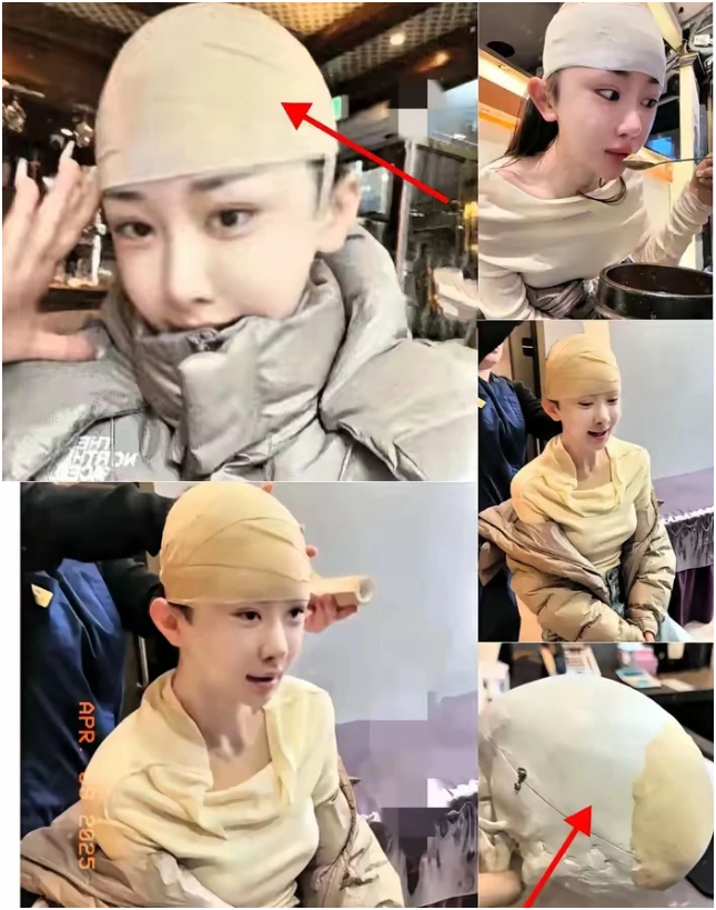 T&igrave;m hiểu xu hướng cao hộp sọ ở Trung Quốc v&agrave; những nguy hiểm sức khỏe tiềm ẩn - Ảnh 7.