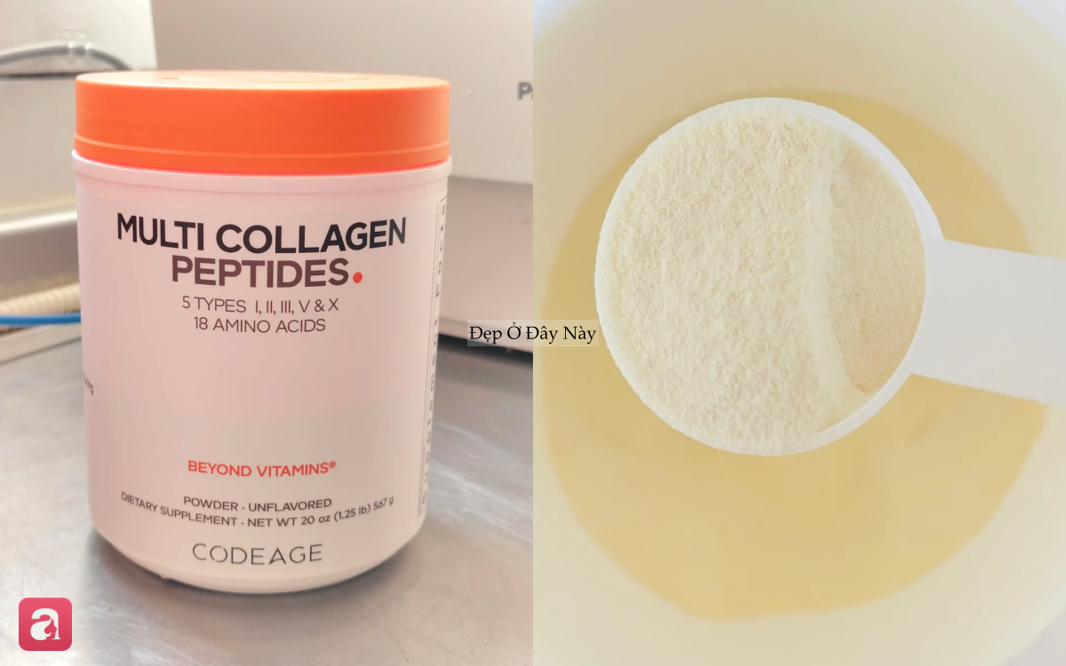 5 lọ bột collagen từ b&igrave;nh d&acirc;n tới cao cấp, d&ugrave;ng 1 th&igrave;a mỗi ng&agrave;y sẽ thấy nếp nhăn li ti dần biến mất - Ảnh 2.