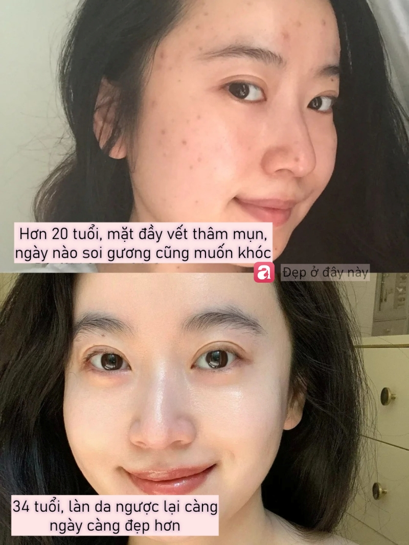 34 tuổi da lại đẹp hơn tuổi 20: B&iacute; quyết kh&ocirc;ng nằm ở mỹ phẩm đắt tiền m&agrave; ở 3 th&oacute;i quen n&agrave;y- Ảnh 1.