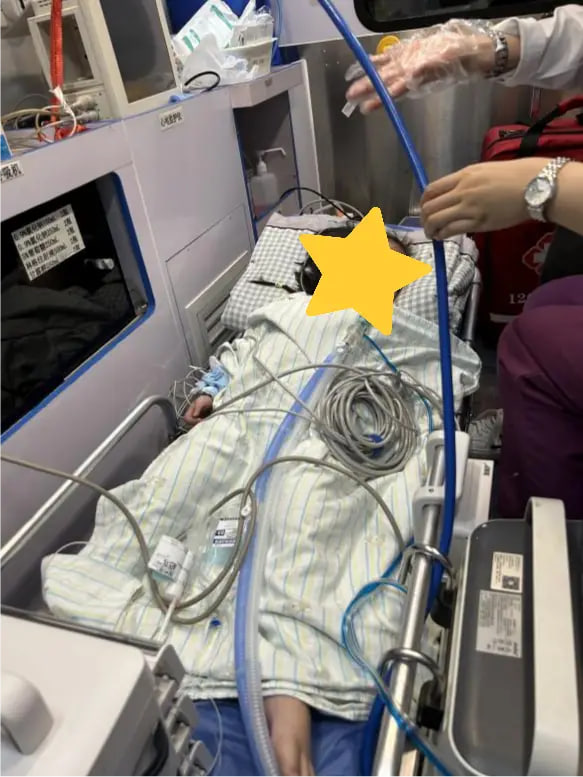 Bé 2 tuổi ăn đậu phộng suýt mất mạng, tim ngừng đập khi đến viện - Ảnh 1.