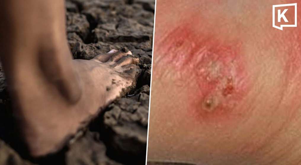 Th&aacute;i Lan b&aacute;o động về dịch sốt đất 2026: 732 Ca nhiễm v&agrave; 23 ca tử vong - Ảnh 1.