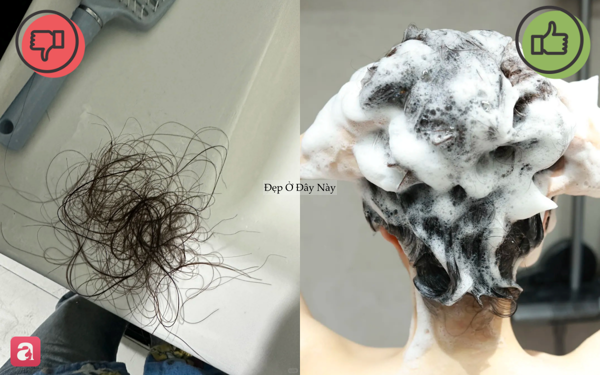 T&oacute;c rụng x&aacute;c xơ, c&ograve;n ngả v&agrave;ng hoe v&agrave;o m&ugrave;a h&egrave;: 5 sai lầm phổ biến nhiều người vẫn mắc phải - Ảnh 2.