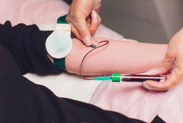 Xuất huyết n&atilde;o kh&ocirc;ng đến 