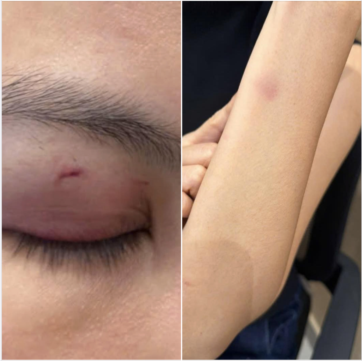 B&aacute;c sĩ thẩm mỹ tố ca sĩ Trung Qu&acirc;n h&agrave;nh hung vợ m&igrave;nh: Vụ việc g&acirc;y x&ocirc;n xao - Ảnh 1.