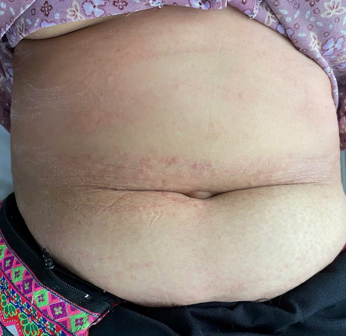 Đi tảo mộ, 8 người nhập viện gấp v&igrave; điều n&agrave;y - Ảnh 1.