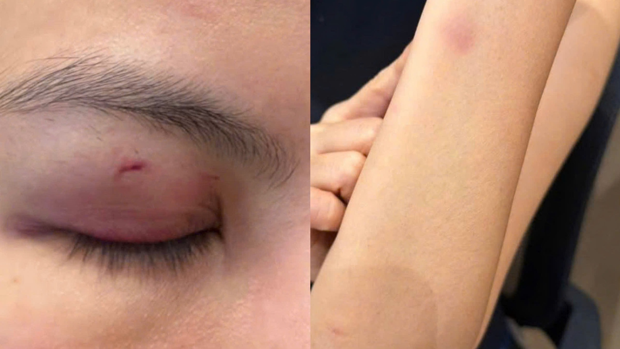 Luật sư nhận định vụ ca sĩ Trung Qu&acirc;n Idol bị tố đ&aacute;nh phụ nữ tại TPHCM - Ảnh 1.