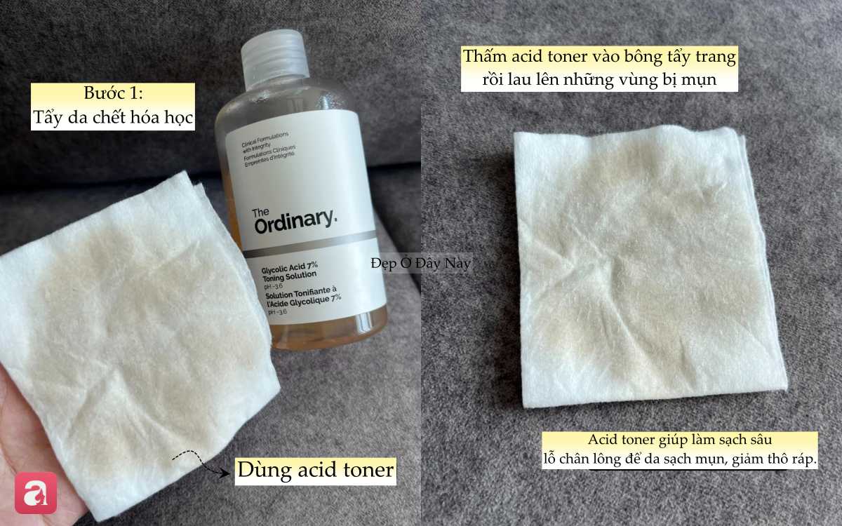 Mụn lưng &ldquo;bay sạch&rdquo;, da mịn như em b&eacute; với c&aacute;ch chăm da đơn giản của n&agrave;ng blogger Trung Quốc - Ảnh 2.