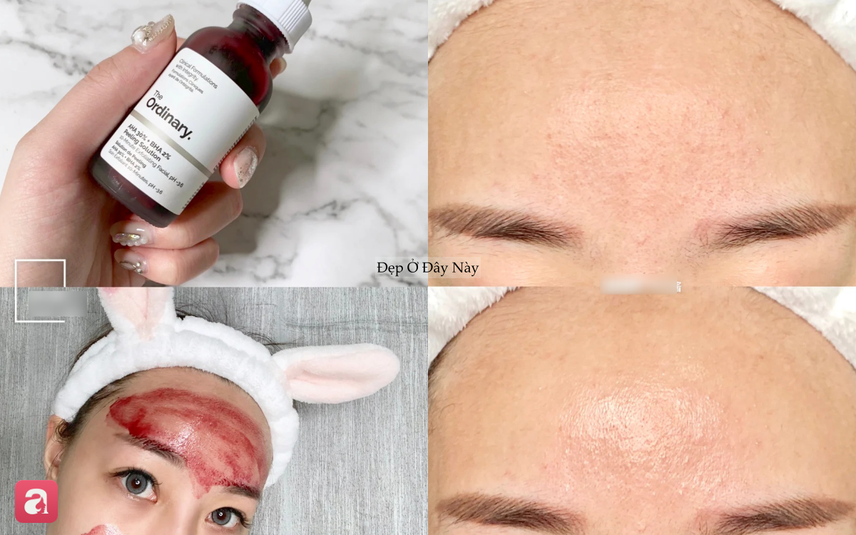 Loại serum 