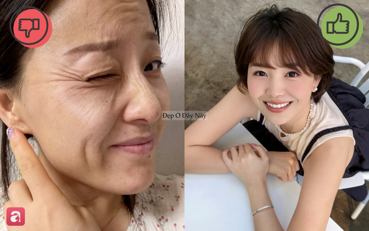 6 th&oacute;i quen tai hại khiến nếp nhăn v&ugrave;ng mắt ng&agrave;y c&agrave;ng hằn s&acirc;u, đẩy nhanh l&atilde;o h&oacute;a - Ảnh 1.