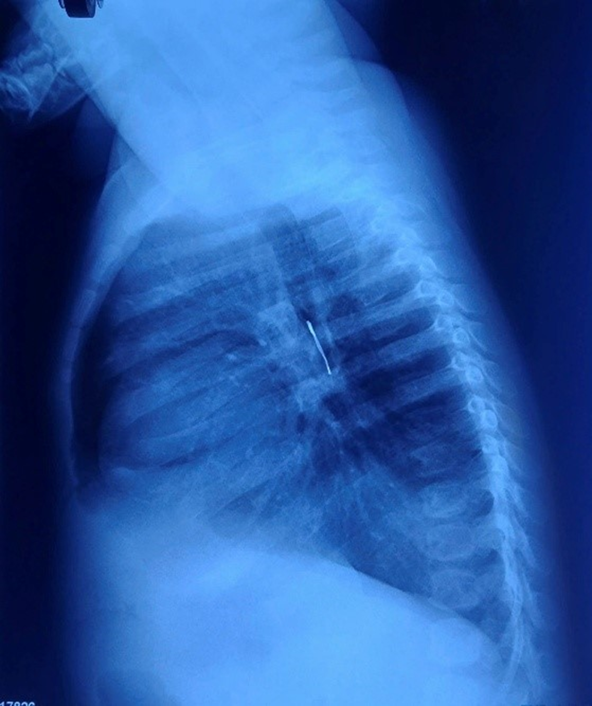 B&eacute; 9 th&aacute;ng tuổi ho nhiều ng&agrave;y, bố mẹ 