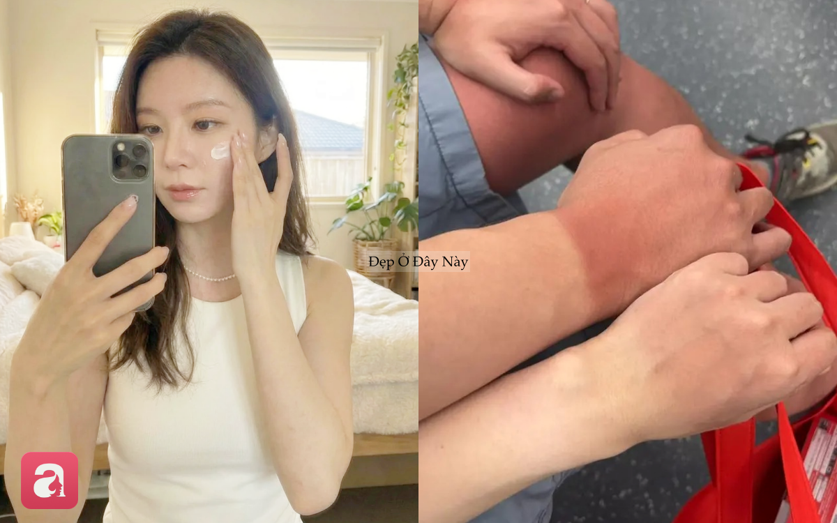 B&ocirc;i kem chống nắng kiểu n&agrave;y, da kh&ocirc;ng chỉ sạm đen m&agrave; c&ograve;n l&atilde;o h&oacute;a nhanh - Ảnh 1.