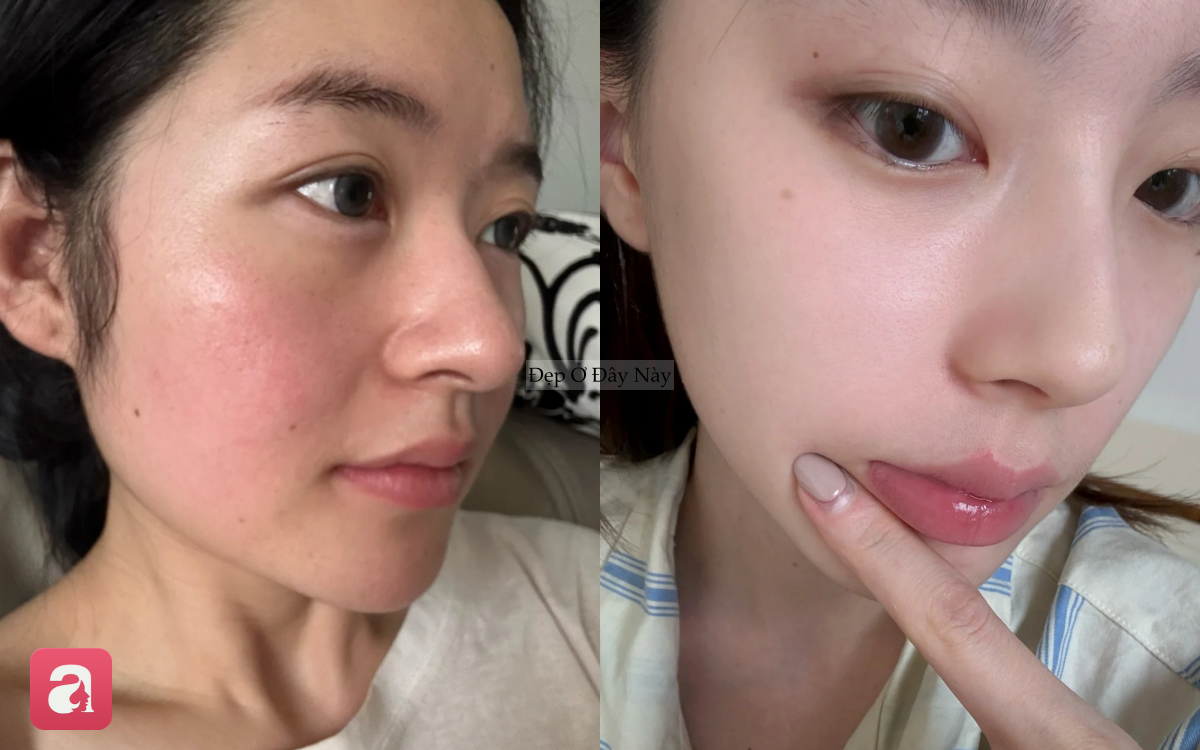 Mua kem dưỡng đắt tiền cũng 