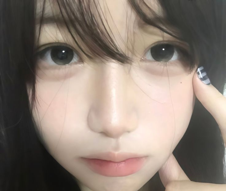 C&aacute;c b&aacute;c sĩ khuy&ecirc;n: Kh&ocirc;ng cần chờ tới l&uacute;c ngứa da, thấy 7 dấu hiệu n&agrave;y tr&ecirc;n mặt tức l&agrave; m&aacute;u đ&atilde; 