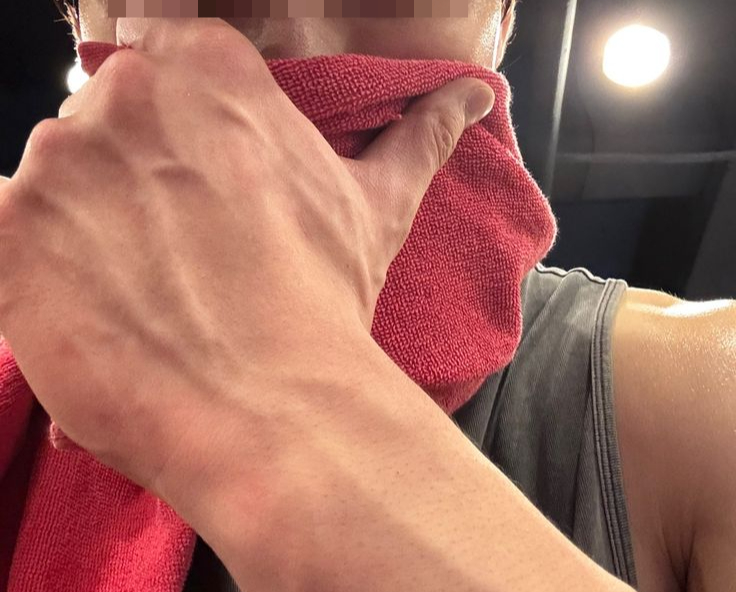 Ch&agrave;ng trai ngo&agrave;i 20 tuổi bị s&ugrave;i m&agrave;o g&agrave; khẳng định chưa từng l&agrave;m 