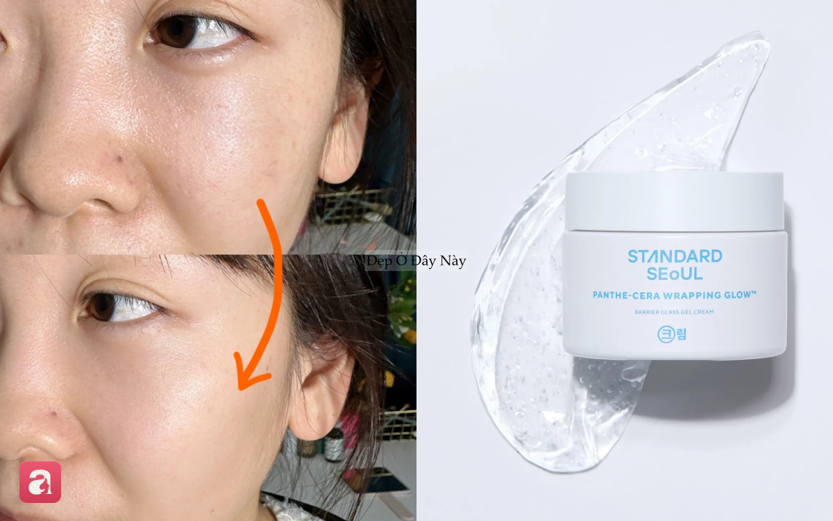 M&ugrave;a h&egrave; đến rồi: 5 m&oacute;n skincare bạn n&ecirc;n đổi ngay để da kh&ocirc;ng 