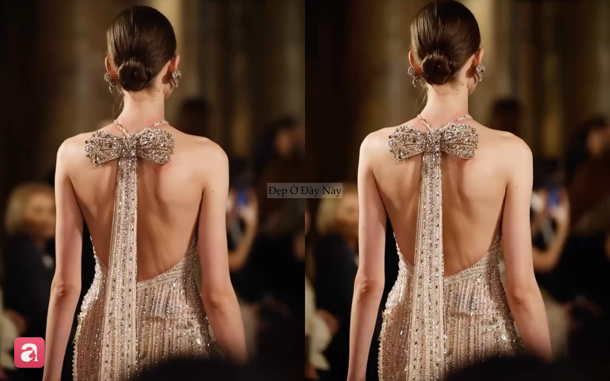 Nỗi đau ph&iacute;a sau chiếc đầm lộng lẫy khiến triệu người x&oacute;t xa - Ảnh 4.