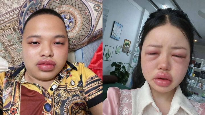 Tại sao b&aacute;nh trứng kiến lại trở th&agrave;nh tr&agrave;o lưu ẩm thực g&acirc;y sốt trong giới trẻ 2026 - Ảnh 4.