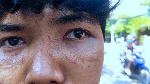 Cụ b&agrave; bị Nnam thanh ni&ecirc;n h&agrave;nh hung ở qu&aacute;n ăn khuya tại Gia Lai: Gia đ&igrave;nh xin được bỏ qua - Ảnh 2.