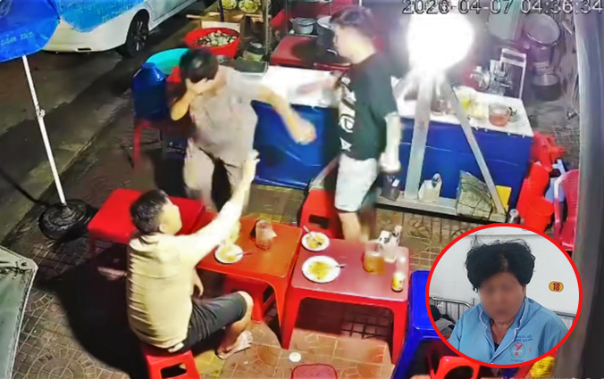 Cụ b&agrave; bị Nnam thanh ni&ecirc;n h&agrave;nh hung ở qu&aacute;n ăn khuya tại Gia Lai: Gia đ&igrave;nh xin được bỏ qua - Ảnh 3.