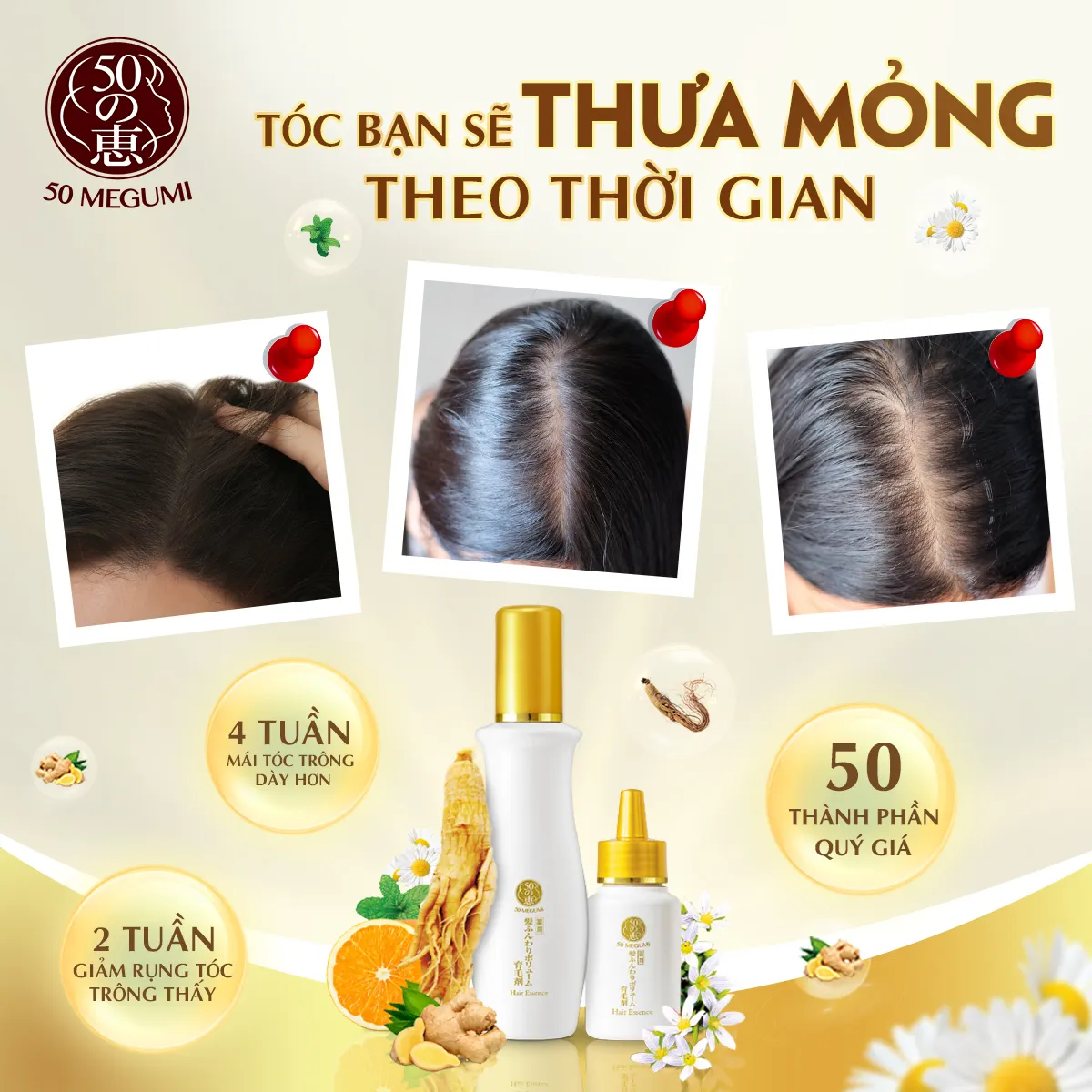 T&oacute;c rụng từng nắm vẫn 